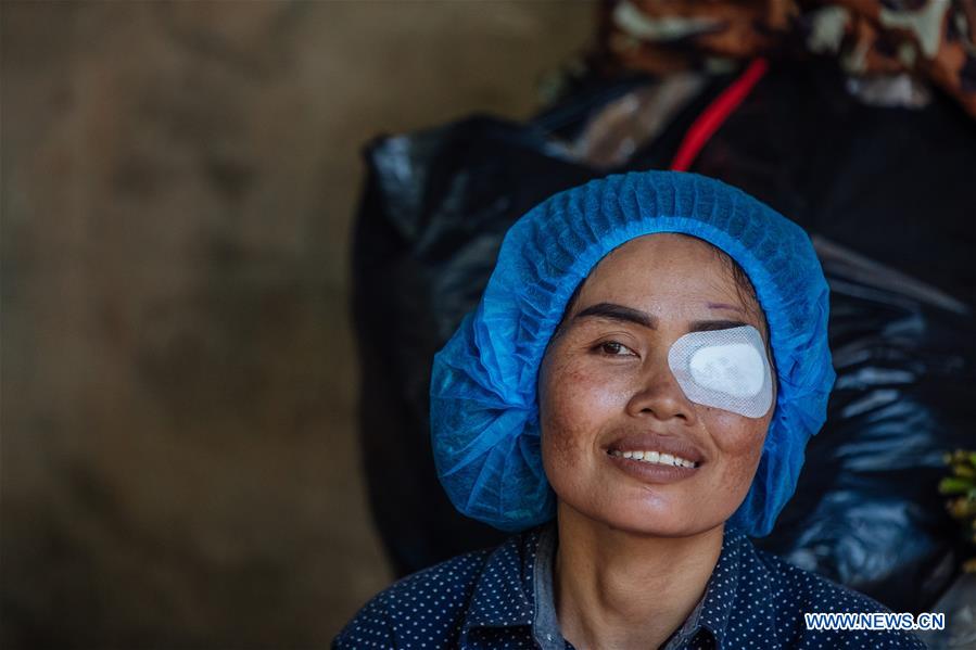 CAMBODIA-KAMPONG CHAM-CHINESE MEDICAL WORKERS-CATARACT-TREATMENT